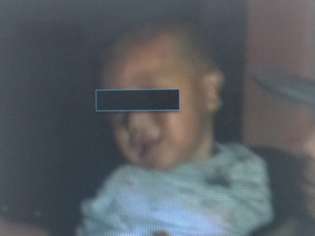 Bebe se escapa de casa hogar en Texcoco