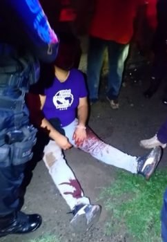 Transeúnte es herido con un arma de fuego al oponerse a un asalto en Valle De Chalco
