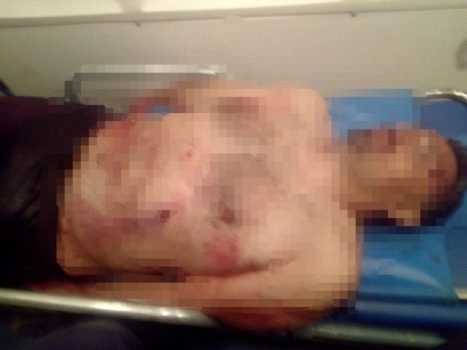 Riña deja a una persona herida por arma de fuego en Valle de Chalco